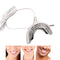 Blanqueador Dental LED Portátil con Carga USB - Dispositivo de Blanqueamiento Profesional