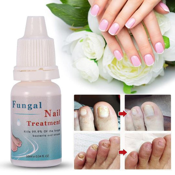 Líquido Reparador de Uñas 10ml - Tratamiento Nutritivo con Acción Esterilizante