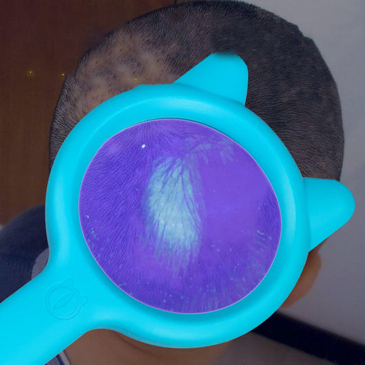 Lámpara Detectora de Hongos UV - Image 4