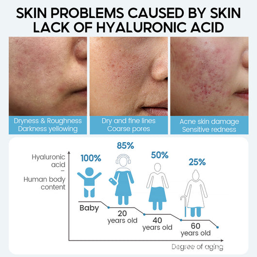 Sérum Facial de Ácido Hialurónico Anti-Envejecimiento con Efecto Reductor de Poros - Image 3