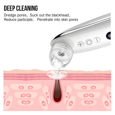 Extractor de Puntos Negros Facial - Image 2