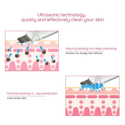 Limpiador Ultrasónico Facial con Masaje Vibratorio - Eliminador de Puntos Negros y Acné - Image 4
