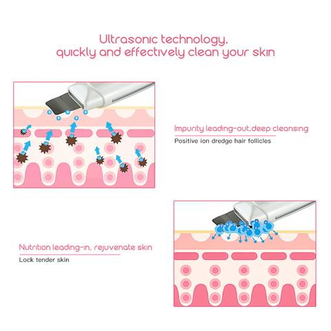 Limpiador Ultrasónico Facial con Masaje Vibratorio - Eliminador de Puntos Negros y Acné - Image 4