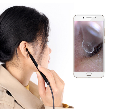 Otoscopio Digital 3 en 1 con Endoscopio HD 1.3MP - Image 8