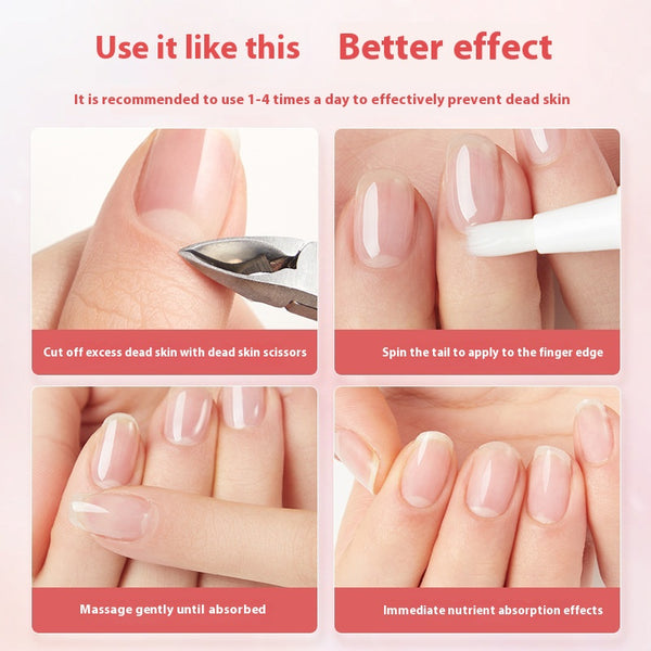 Bolígrafo Nutritivo para Cutículas y Uñas - Eliminador de Piel Muerta