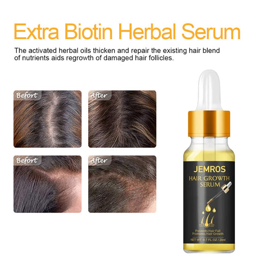 Aceite Esencial Regenerador para el Crecimiento del Cabello - Image 5