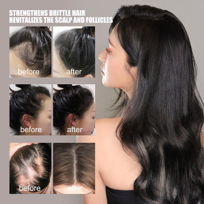 Aceite Esencial Reparador para el Crecimiento del Cabello - Image 10