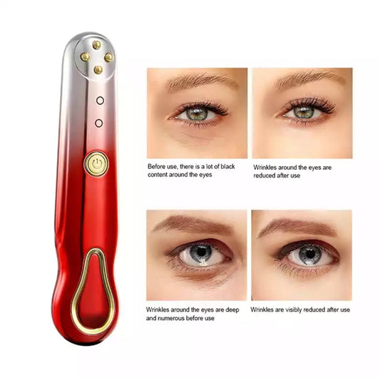 Masajeador Facial RF Anti-Arrugas con Radiofrecuencia y Vibración - Image 2