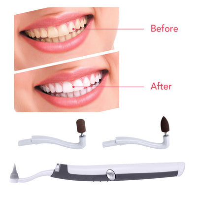 Limpiador Sónico LED para Manchas de Dientes - Image 3