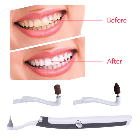 Limpiador Sónico LED para Manchas de Dientes - Image 3