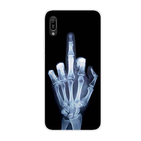 Funda para móvil con diseño de caricatura adorable - Protección contra caídas