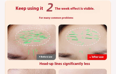 Dispositivo de Lifting Facial con Microcorriente - Rejuvenecimiento y Tonificación - Image 14