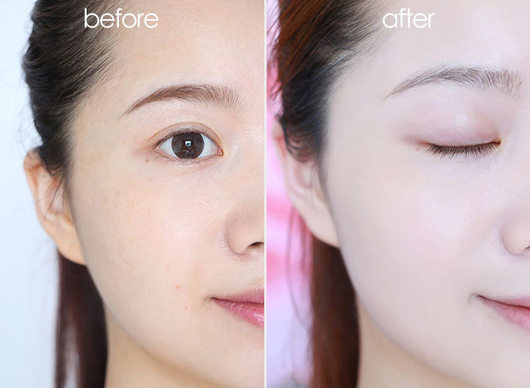 Crema Correctora de Pecas - Image 3