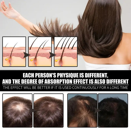 Aceite de Ricino Puro - Cuidado Integral para Cabello, Cuerpo y Rostro - Image 3