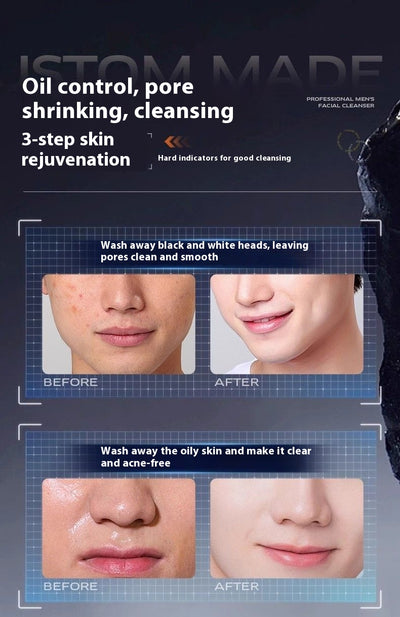 Limpiador Facial Antibacterial Regulador de Grasa y Eliminador de Puntos Negros para Hombres - Image 23