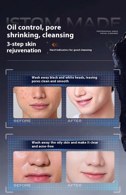 Limpiador Facial Antibacterial Regulador de Grasa y Eliminador de Puntos Negros para Hombres - Image 23