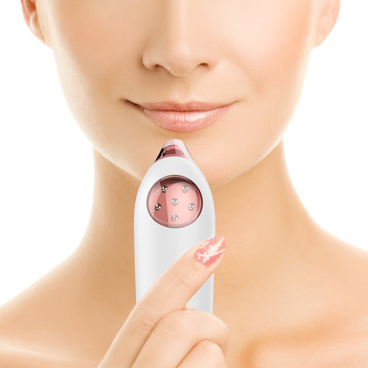 Extractor de Puntos Negros con Succión Eléctrica - Limpiador Facial Profesional - Image 3