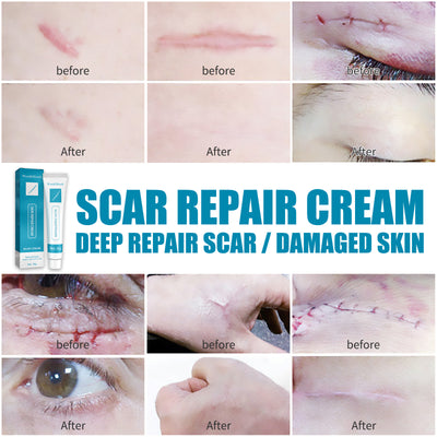 Crema Reparadora de Cicatrices Piel Lisa - Image 2