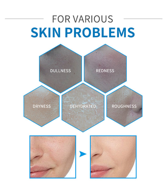 Set Completo de Ácido Hialurónico para Hidratación Facial Profunda - Image 17