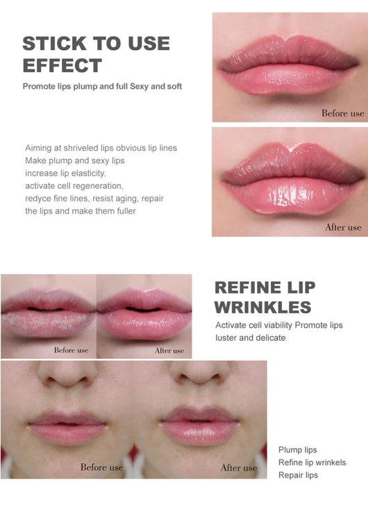 Gloss Labial Relleno de Líneas de Expresión - Image 19