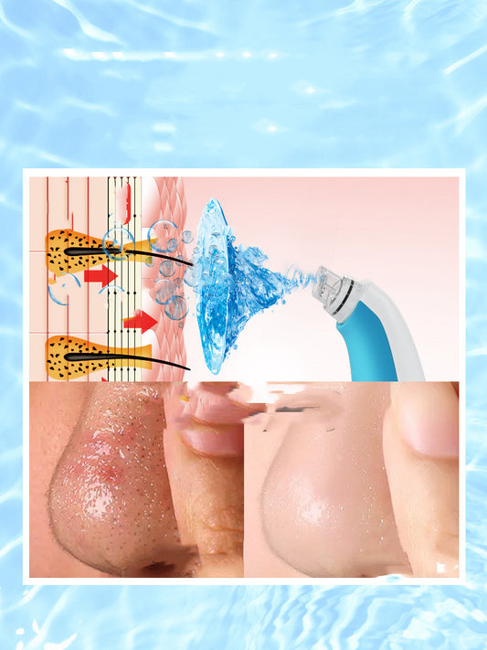 Limpiador de Poros con Burbujas - Instrumento de Belleza Facial - Image 2