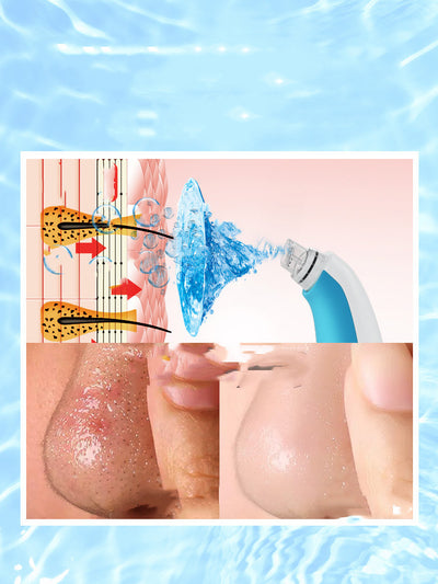 Limpiador de Poros con Burbujas - Instrumento de Belleza Facial - Image 2