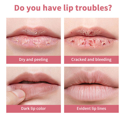 Labial Brillo Hidratante con Miel y Efecto Lubricante - Image 10