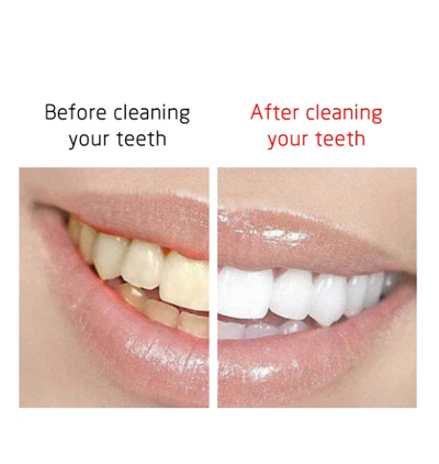 Removedor Ultrasónico de Sarro y Placa Dental - Image 13