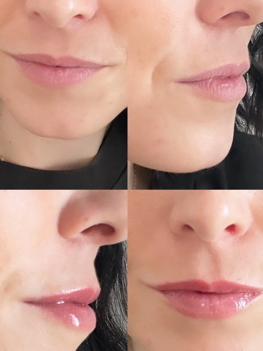 Óleo Labial Preenchedor