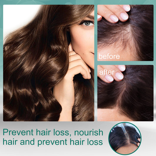 Aceite Esencial Fortalecedor de Jengibre Maduro para el Cabello - Image 5