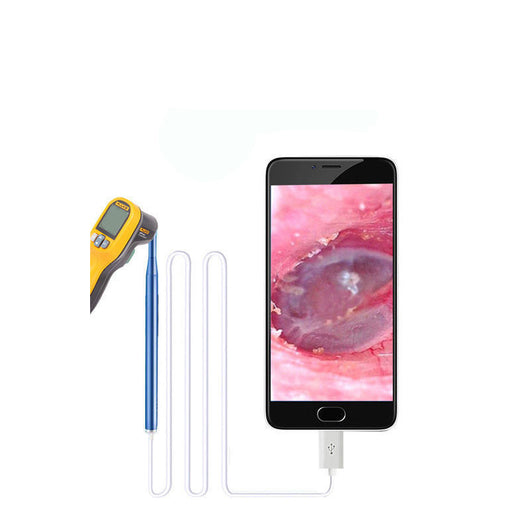Extractor de Cerumen Luminoso para Niños con Visualización LED - Image 8