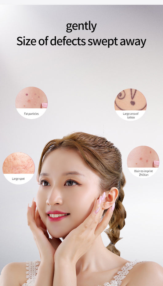 Bolígrafo Láser LCD para Eliminar Pecas y Lunares - Image 6