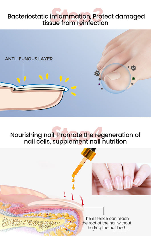 Solución Integral para Hongos en Uñas - Aceite Esencial Esterilizante - Image 13