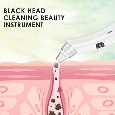 Limpiador Facial Eléctrico de Poros - Extractor de Puntos Negros y Acné - Image 18