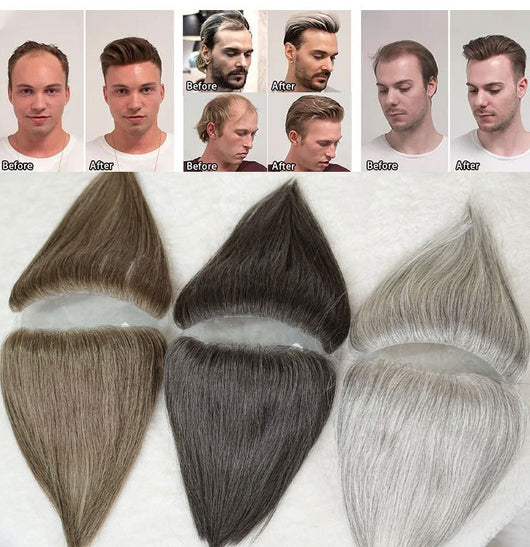 Parches Capilares Invisibles para Hombre - Solución Instantánea de Densidad - Image 13