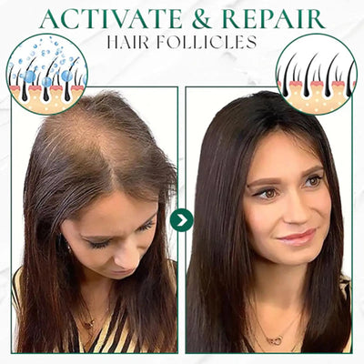 Aceite Esencial para Masaje Facial de Salón de Belleza - Image 16