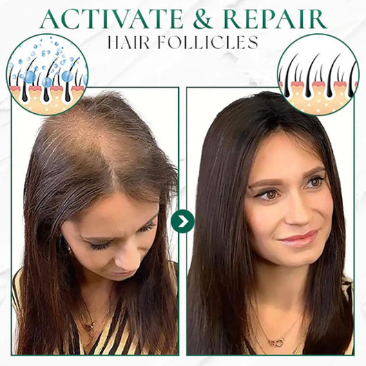 Aceite Esencial para Masaje Facial de Salón de Belleza - Image 16