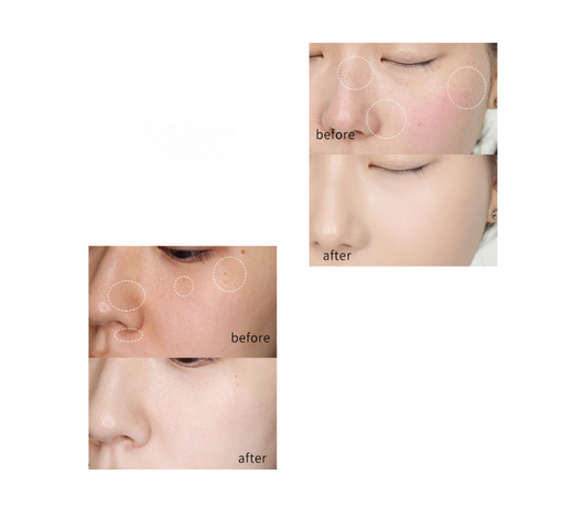 Crema Aclarador Antimanchas con Efecto Iluminador - Image 7