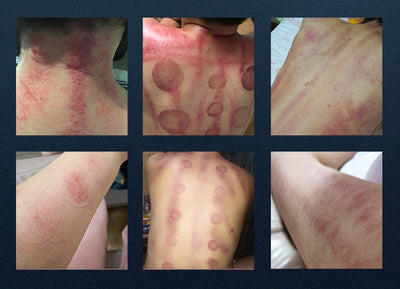 Dispositivo de Belleza Láser Multifuncional 5 en 1 - Rejuvenecimiento Facial y Corporal - Image 7