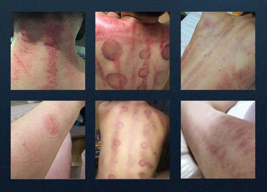 Dispositivo de Belleza Láser Multifuncional 5 en 1 - Rejuvenecimiento Facial y Corporal - Image 7