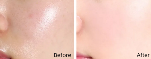 Corrector Impecable Meiqian - Cobertura Total para Manchas y Tatuajes - Image 14