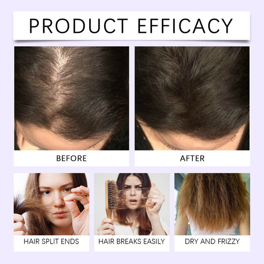 Cápsulas de Aceite Esencial para Cabello - Tratamiento Diario Hidratante y Restaurador - Image 16