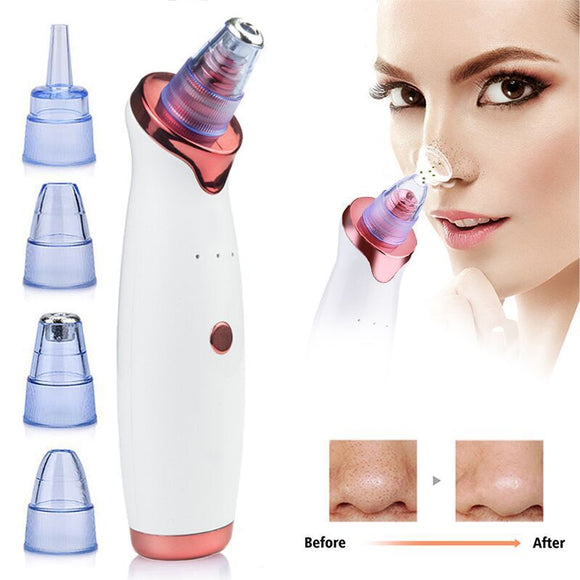 Limpiador Facial Ultrasónico Anti-Acné