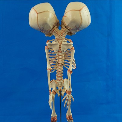 Modelo Anatómico Doble de Hueso Infantil para Enseñanza Médica - Image 8