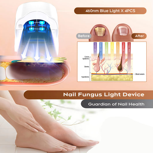 Dispositivo Láser LED Recargable para Eliminar Hongos en Uñas - Image 8