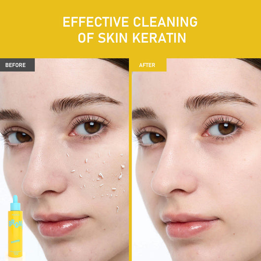 Tónico Exfoliante de Ácido Glicólico AHA Iluminador - Image 24