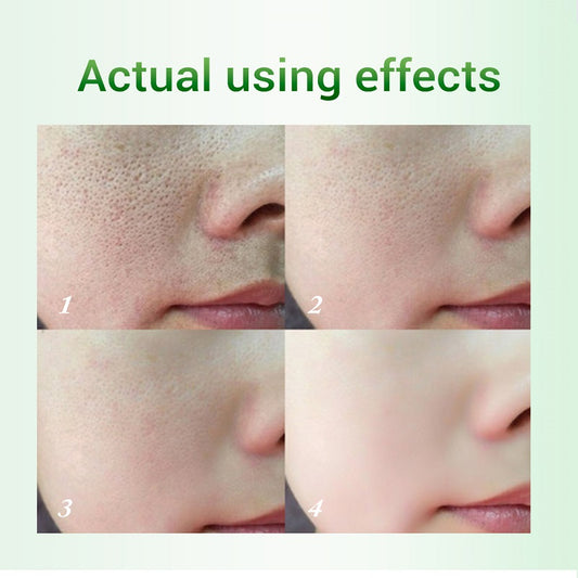 Crema Refinadora de Poros con Ácido Salicílico - Rejuvenecimiento Cutáneo - Image 2