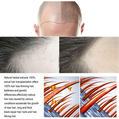 Solución Nutritiva para el Cabello con Jengibre - Image 5