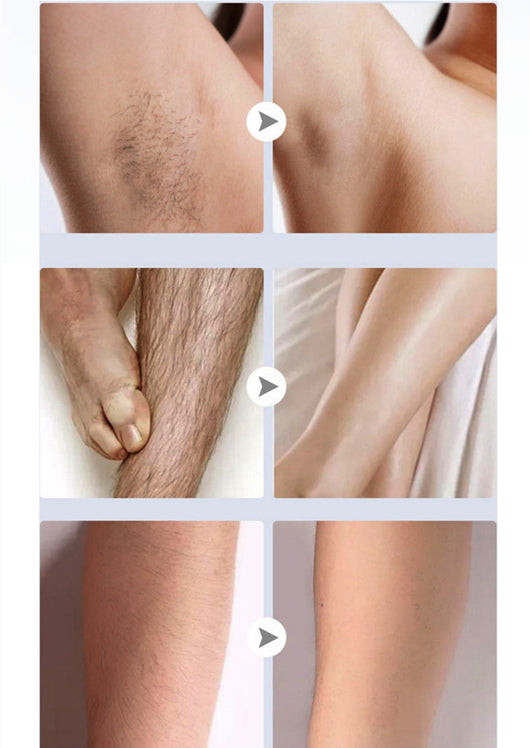 Depiladora Eléctrica para Cuerpo Completo - Afeitadora Indolora para Axilas, Piernas y Zona Íntima - Image 5