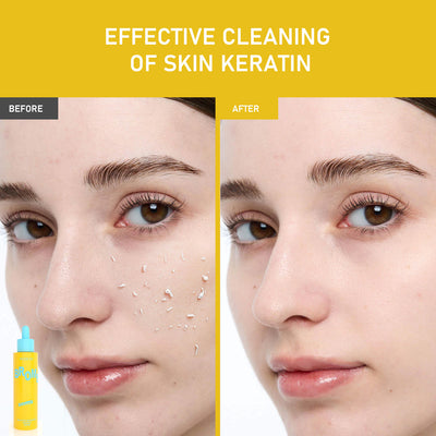 Tónico Exfoliante de Ácido Glicólico AHA Iluminador - Image 11